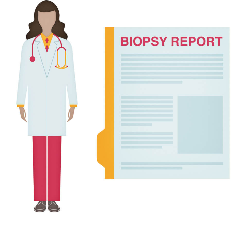 Inflammatory Breast Cancer Biopsy